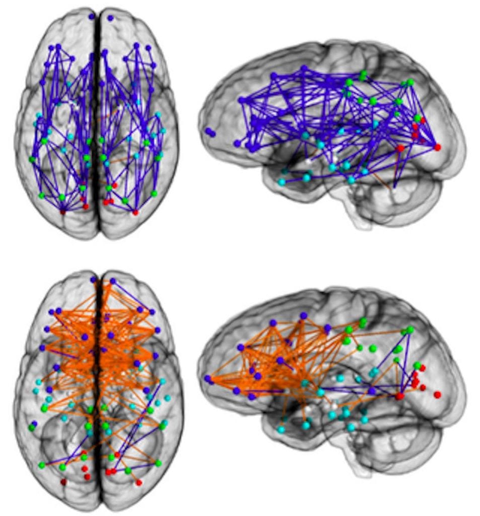 Fig. 1 cervello di uomo e di donna - funzionamento